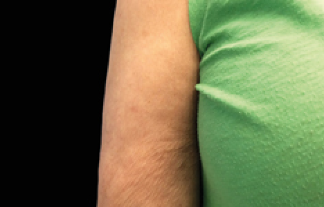 womans arm