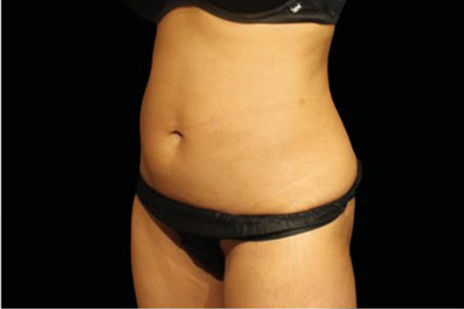 womans waist