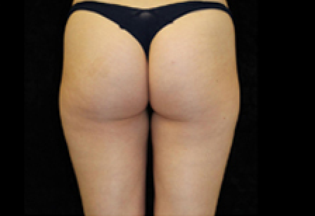 womans butt