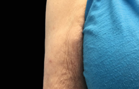 womans arm