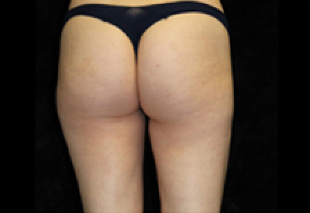 womans butt