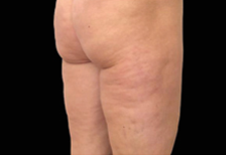 womans butt