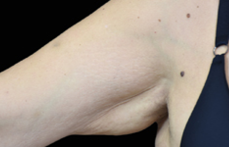 womans arm