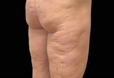 womans butt