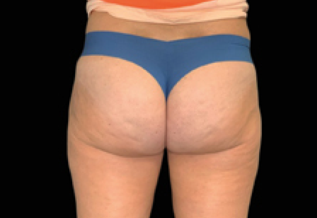 womans butt