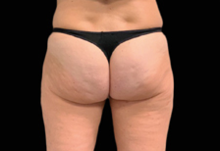 womans butt