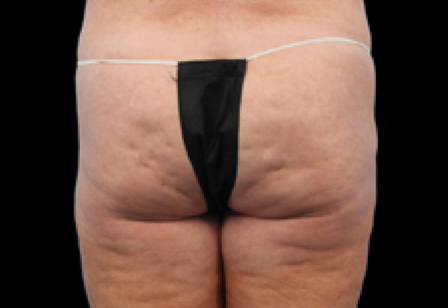 womans butt