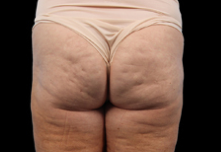 womans butt