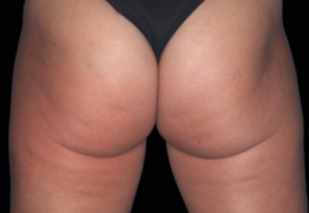 womans butt