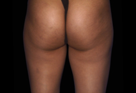 womans butt