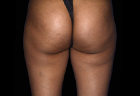 womans butt