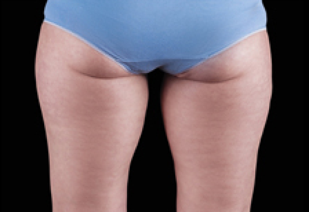 womans butt