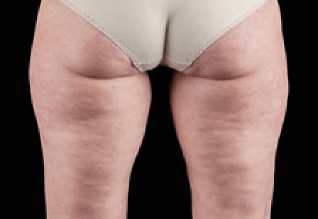 womans butt
