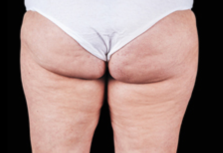 womans butt