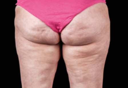 womans butt