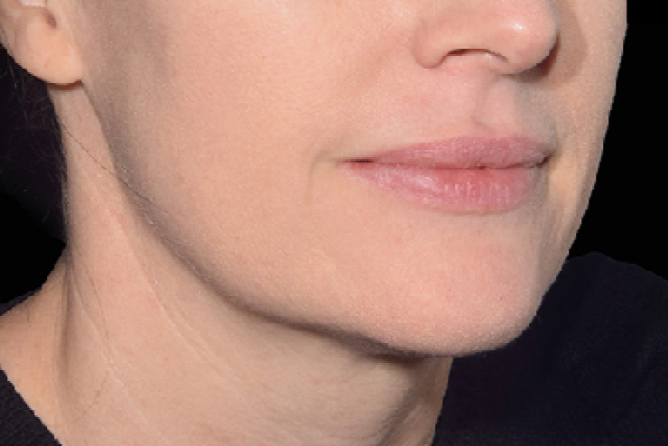 woman face