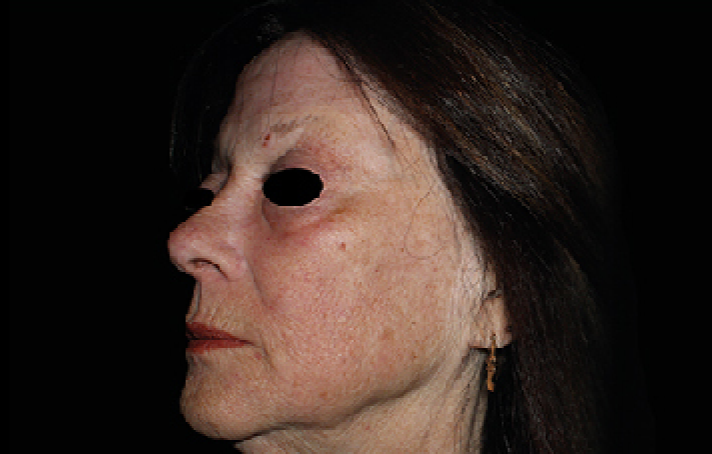 womans face