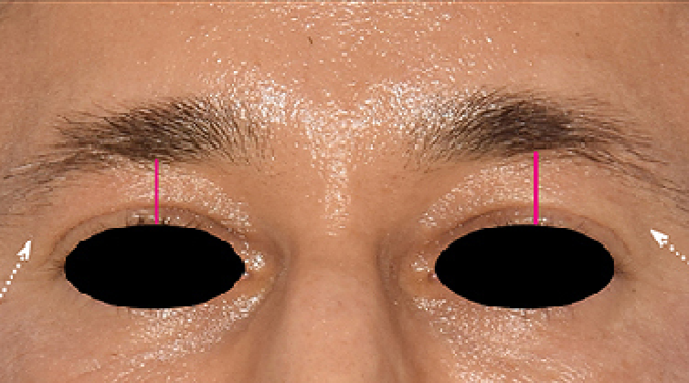 face