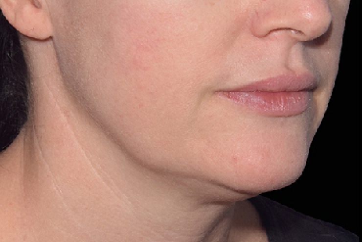 woman face