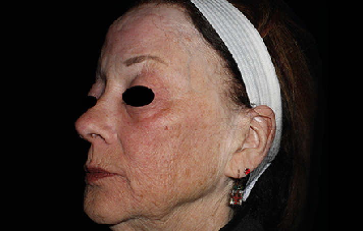 womans face