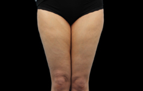 womans legs